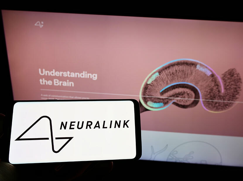 Neuralink’in insanlı deneyine FDA engeli